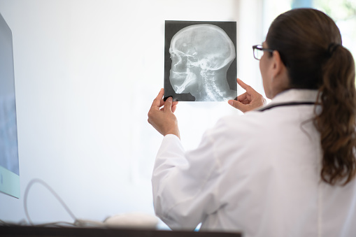 A female doctor looks an x-ray image while sitting at her modern desk. The x-ray is of a human's head.