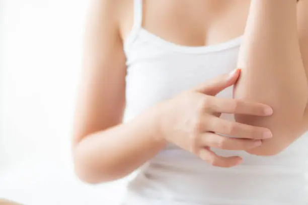 Photo of Closeup elbow of beautiful asian woman applying skincare and moisturizer cream or treatment for scratch and itchy, asia girl applying cream and lotion for dryness of skin care with cosmetic makeup.