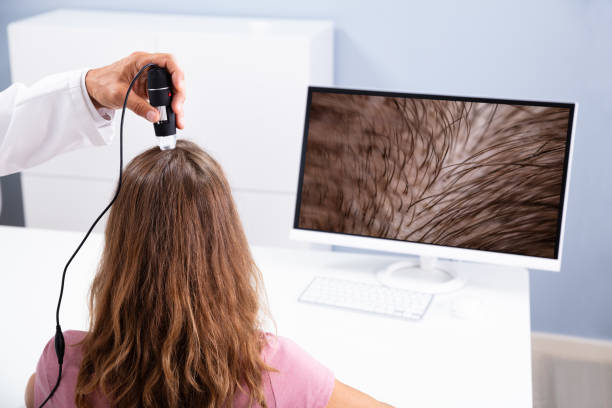 dermatologo che utilizza il trichoscope per il trattamento della caduta dei capelli - loose hair foto e immagini stock