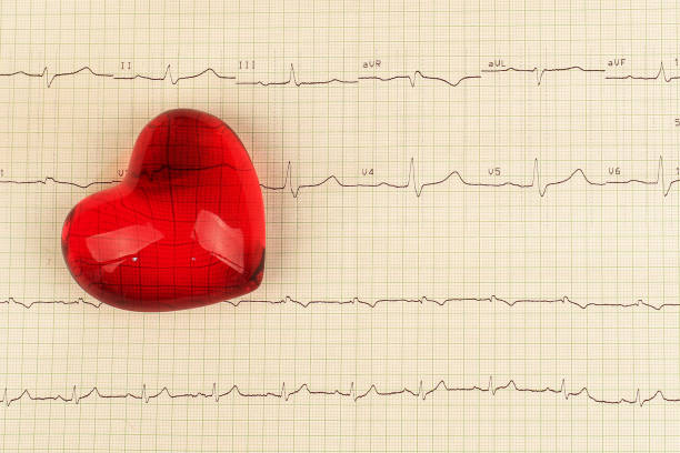 Printed ECG, as background. Decorative heart lies on the cardiogram.