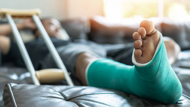 pied et jambe de fracture d'os sur le patient masculin présentant la fonte et les béquilles d'attelle pendant la réadaptation de chirurgie et le rétablissement orthopédique restant à la maison - blessure physique photos et images de collection