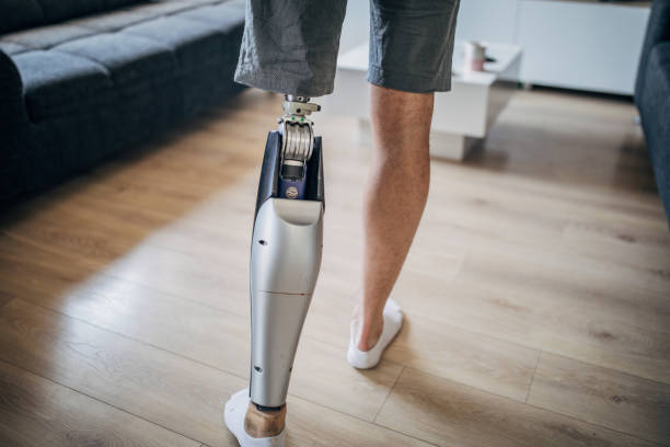 istock Man with one prosthetic leg at home 1170267529