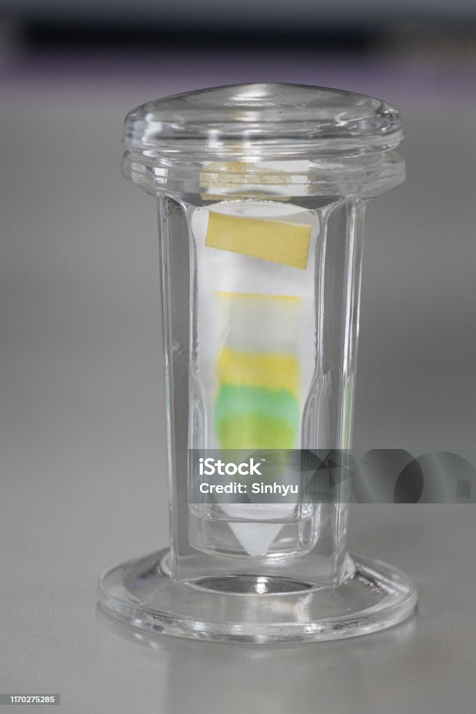 Study of Chromatography is used to separate components of a plant. Layered Stock Photo