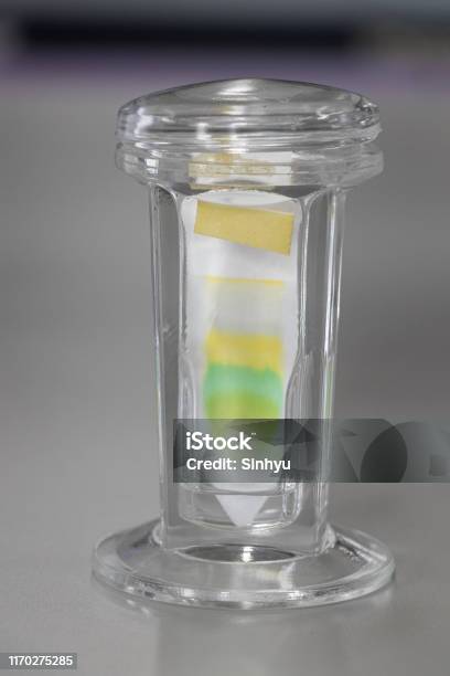 Study Of Chromatography Is Used To Separate Components Of A Plant Stock Photo - Download Image Now