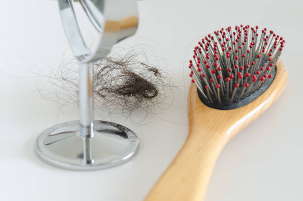 istock Combing with hair loss on a white background 1170298354
