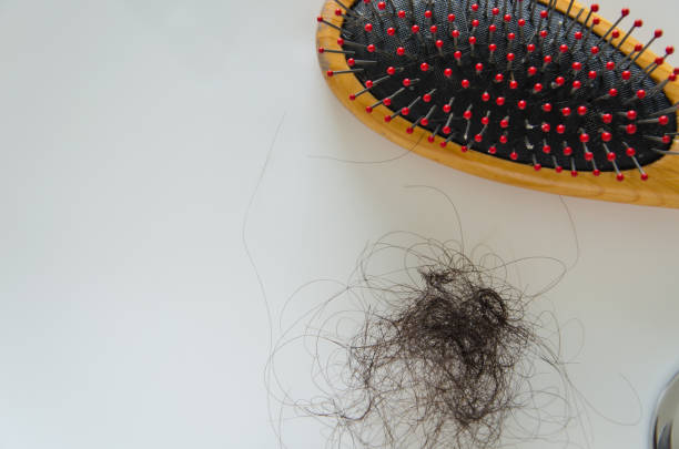 istock Combing with hair loss on a white background 1170298462