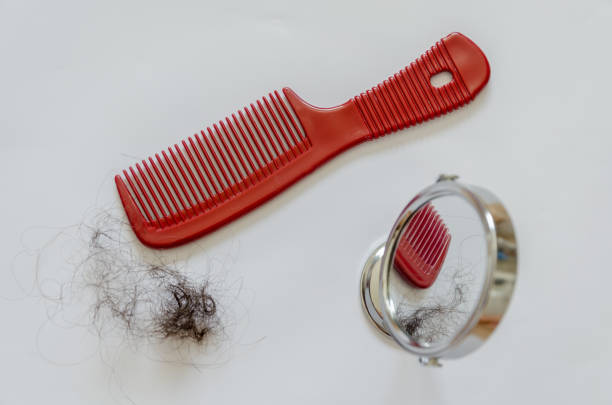 istock Combing with hair loss on a white background 1170298488