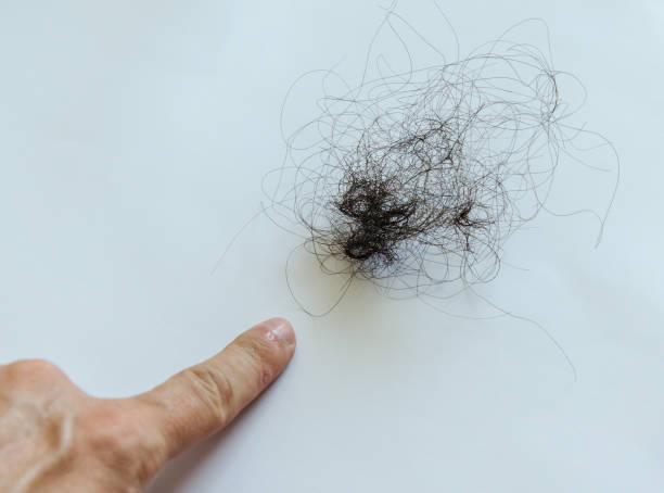 istock Combing with hair loss on a white background 1170298517