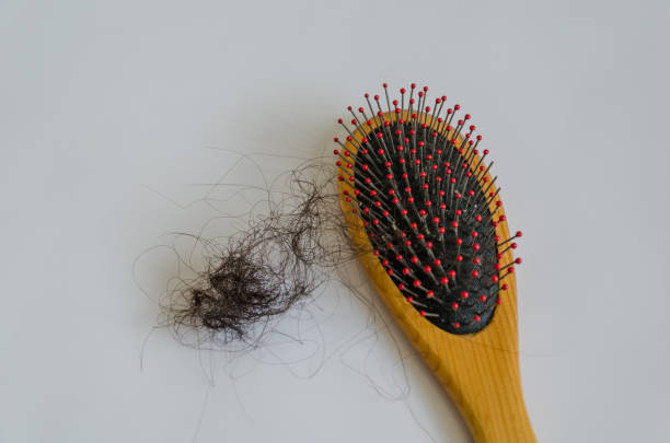 istock Combing with hair loss on a white background 1170298518
