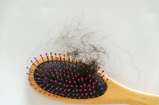 istock Combing with hair loss on a white background 1170298533