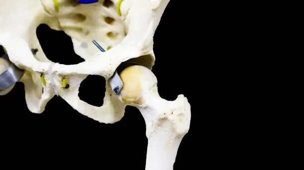 Photo of photograph of articulated hip joint in black background