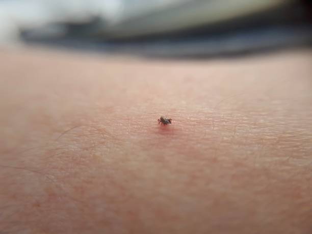 istock Plague ticks. Lyme disease and meningitis 1170365497
