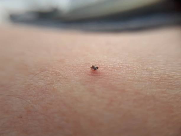 istock sucking tick, ixodes ricinus, sucking on a human 1170365515