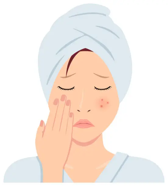 Vector illustration of Young asian woman face vector illustration (just out of the bath)   / acne, treckles