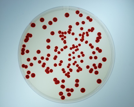 The photograph of prodigiosin producing bacterium, Serratia marcescens, spread on an agar plate represents the concepts of bacterium cultivation, bacterium isolation, and clinical bacteriology.