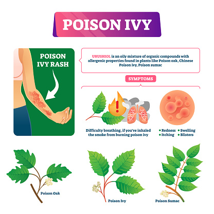 Poison ivy vector illustration. Educational dangerous urushoil plant scheme with symptoms and description. Oak and chinese sumac contact and skin problem causes. Biological health hazard explanation.