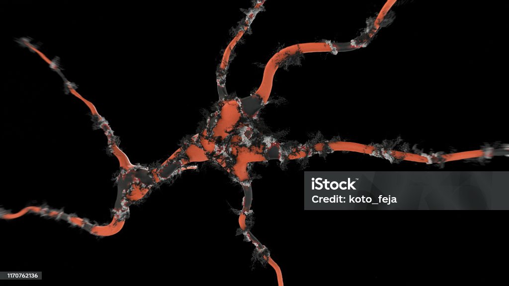 Als Broken Neuron Cell Stock Photo - Download Image Now - Alzheimer's ...