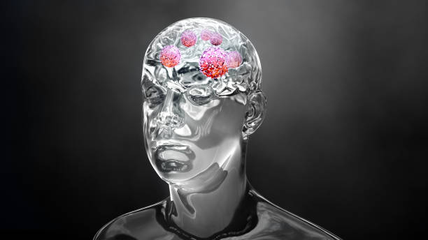 istock Brain cancer or brain tumor in black and white color 1170774151