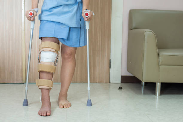 Patient standing on crutch in hospital ward ware knee brace support after do posterior cruciate ligament surgery ,Bandage on knee of asian woman on crutches.healthcare and medical concept. Patient standing on crutch in hospital ward ware knee brace support after do posterior cruciate ligament surgery ,Bandage on knee of asian woman on crutches.healthcare and medical concept. knee brace stock pictures, royalty-free photos & images