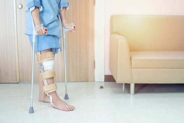 patient versuchen, mit krücken in krankenhaus ware kniespange unterstützung nach tun hinteren kreuzband operation, bandage auf dem knie der asiatischen frau auf krücken gehen.gesundheits- und medizinisches konzept. - cruciate ligament stock-fotos und bilder