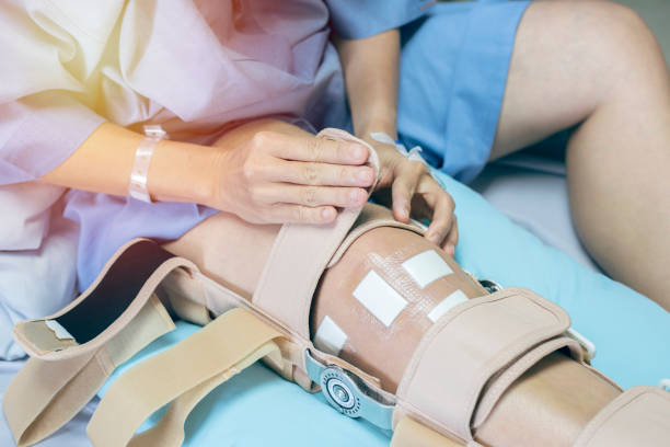 hand von asiatischen frau patient sitzen auf dem bett im krankenhaus versuchen, kniespange unterstützung nach tun hinteren kreuzband-operation tragen. - cruciate ligament stock-fotos und bilder