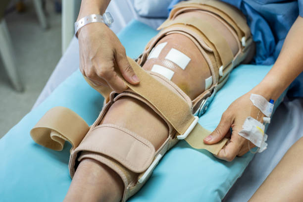 Asian woman patient with bandage compression knee brace support injury on the bed in nursing hospital.healthcare and medical support. Asian woman patient with bandage compression knee brace support injury on the bed in nursing hospital.healthcare and medical support. posterior cruciate ligament stock pictures, royalty-free photos & images