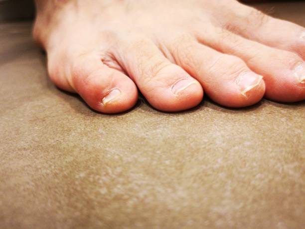 istock Human foot on the tiled floor 1170873496