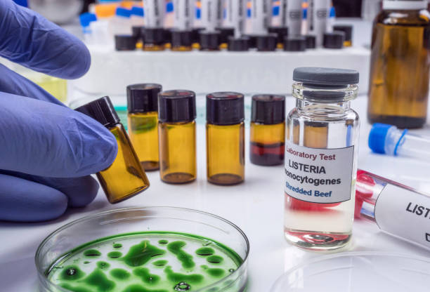 istock Expert analyzes stuffed meat contaminated by bacterium of listeria in laboratory, sprout caused in Spain 1171121422