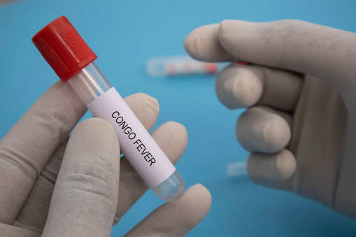 Concept of Laboratory test tube of Crimean Congo hemorrhagic fever or CCHF in hands