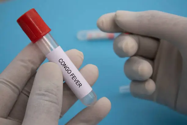 Photo of Concept of Laboratory test tube of Crimean Congo hemorrhagic fever or CCHF in hands.