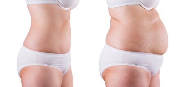 femme âgée avant et après la perte de poids, d'isolement sur le fond blanc - overweight women abdomen pot belly photos et images de collection