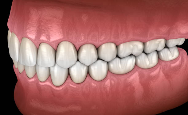 istock Healthy human teeth with normal occlusion, side view. Medically accurate tooth 3D illustration 1171331971