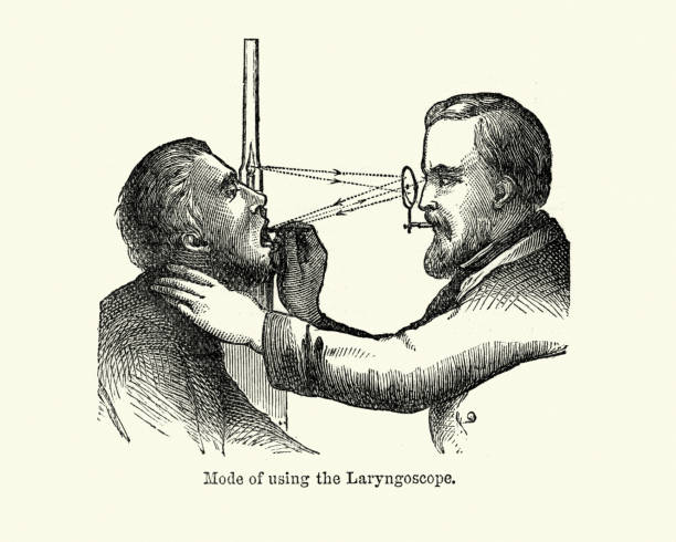 환자 후두를 검사하기 위해 후두경을 사용하는 빅토리아 의사 - laryngoscopy stock illustrations