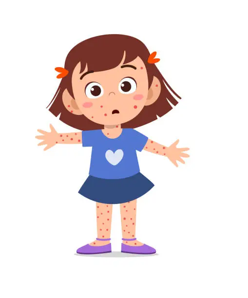 Vector illustration of kid girl having chicken pox vector