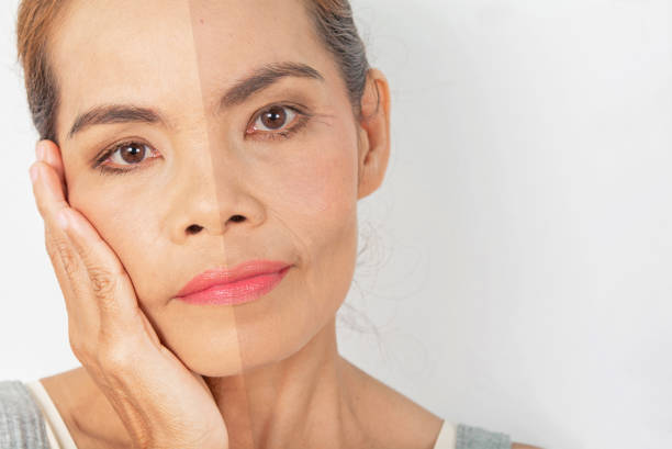istock Wrinkles, cheek grooves, skin problems 1171507999