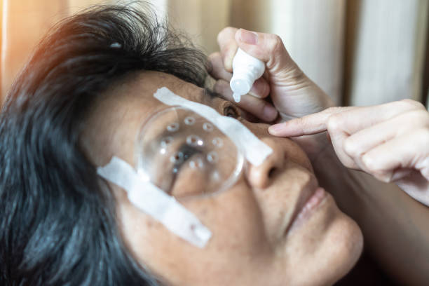 elderly patient woman having eye drop care treatment on age-related eye diseases, amd, cataract, diabetic retinopathy, glaucoma, low vision, dry eyes illness for eye health awareness concept - macular degeneration imagens e fotografias de stock