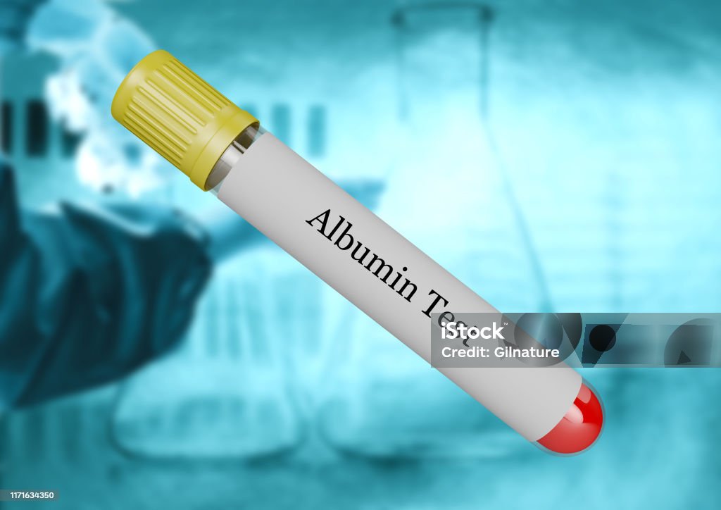 Teste de albumina em sangue coletado em tubo de ensaio isolado por foco seletivo - Foto de stock de Analisar royalty-free