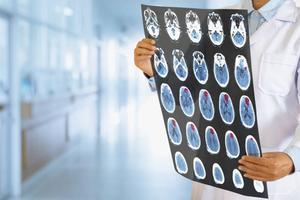 脳のmriスキャンをチェックする医師は、病院病棟の脳腫瘍または脳卒中患者を示す。 - mri scanner healthcare and medicine medical exam brain ストックフォトと画像