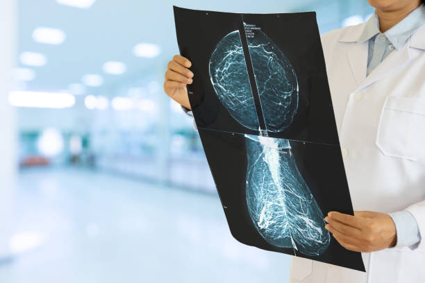 tanınmayan kadın jinekolog hastanede meme kanseri için kontrol bir mamografi bakıyor. - röntgen cihazı stok fotoğraflar ve resimler