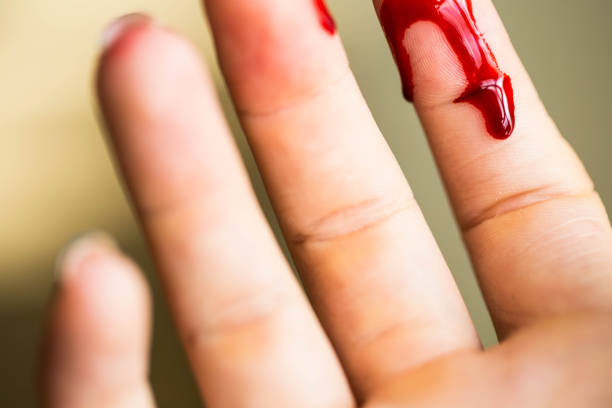 Finger cut, bleeding injured with knife, Flesh blood wound in hand stock photo