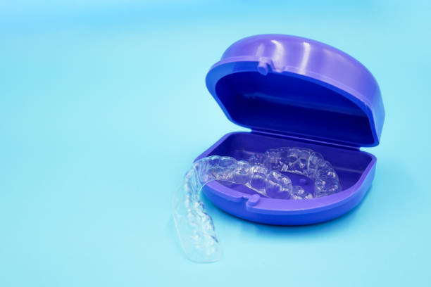 istock clear plastic retainer teeth in the purple box set 1171763718