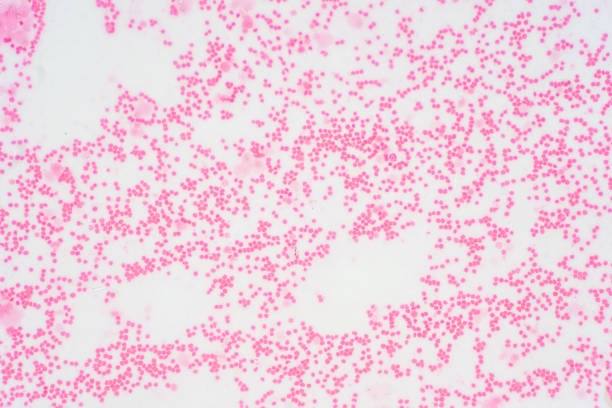 istock Bone marrow biopsy from myelodysplastic condition under the microscope view. Histology tissue of bone marrow biopsy. 1171819762