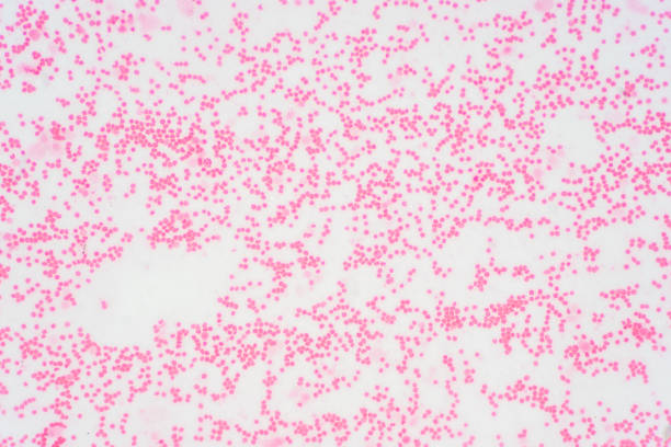 istock Bone marrow biopsy from myelodysplastic condition under the microscope view. Histology tissue of bone marrow biopsy. 1171819763