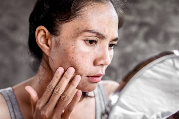 mujer asiática que tiene problemas de piel comprobar su cara con mancha oscura, pecas de la luz uv - quemado por el sol fotografías e imágenes de stock