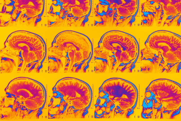 irm du cerveau - mri scan human nervous system brain medical scan photos et images de collection