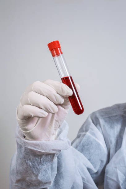 Forensic investigator holding a bottle of blood sample stock photo