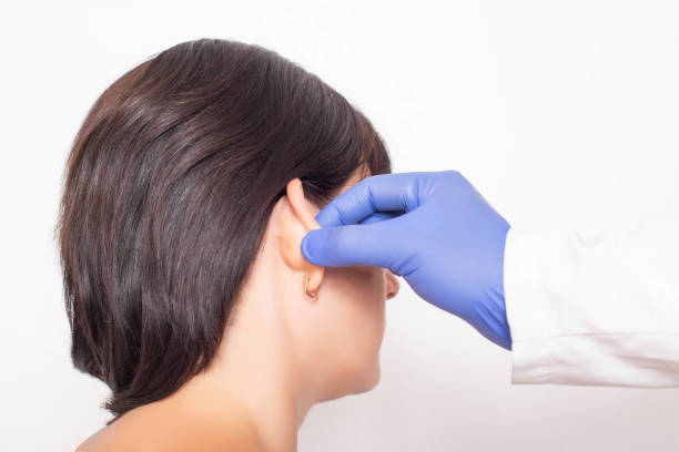 a plastic surgeon doctor examines a patient s girl s ears before performing an otoplasty surgery, close-up - lobe imagens e fotografias de stock