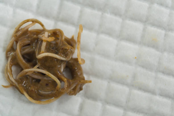 istock feces with Toxocara cati from a stray cat 1172465860