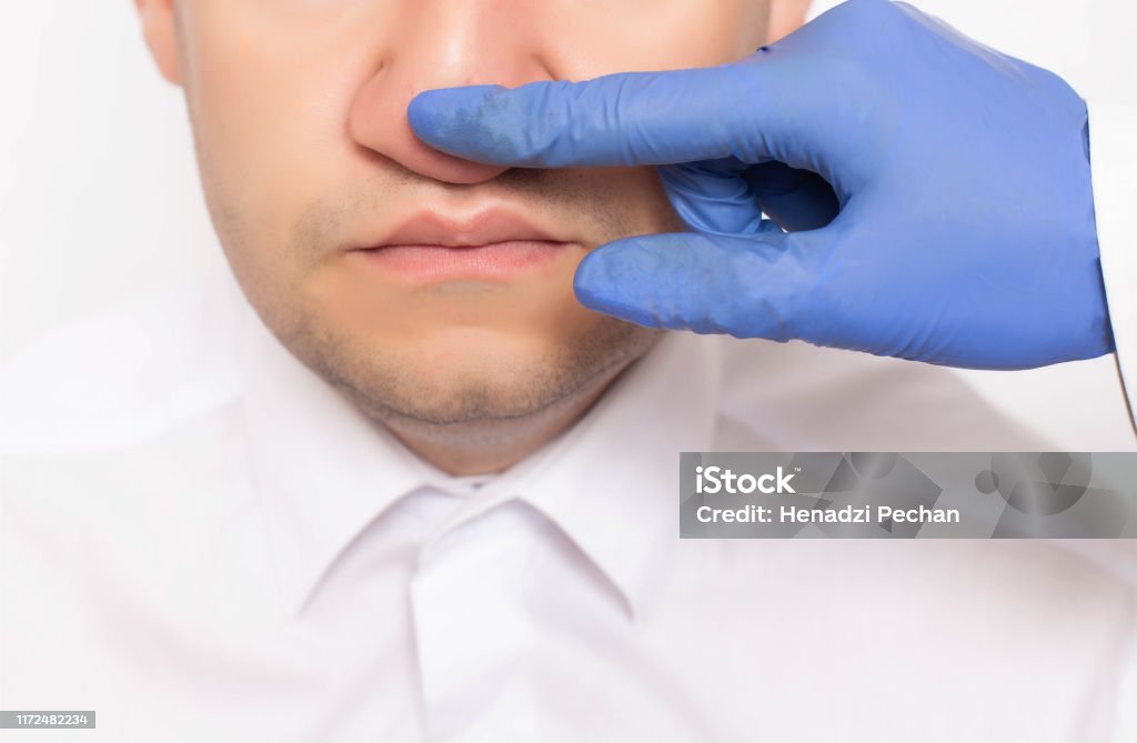 Un Cirujano Plástico Examina La Nariz Del Paciente Masculino De Un Paciente Antes De La Cirugía Rinoplastia Un Método Moderno De Cirugía Plástica Para El Cartílago De La Nariz Tabique Nasal Foto Un Cirujano Plástico Examina La Nariz Del Paciente Masculino De Un Paciente Antes De La Cirugía Rinoplastia Un Método Moderno De Cirugía Plástica Para El Cartílago De La Nariz Tabique Nasal Foto