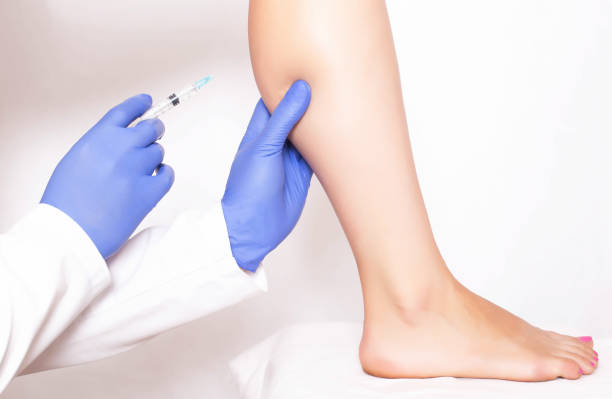 医師の美容師は、女の子の脚のふくらはぎの筋肉に若返り美容注射を行います。ヒラウリ酸の注射で若返り, 医療 - wrinkle treatment doctor surgeon human hand ストックフォトと画像